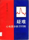 疑难心电图分析200例