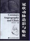 冠状动脉造影与临床