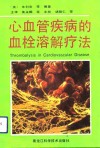 心血管疾病的血栓溶解疗法