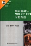 断面解剖与MRI CT ECT对照图谱 中英文本 2 腹部、盆部、四肢部