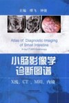 小肠影像学诊断图谱  X线、CT、MRI、内镜