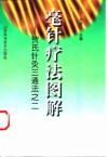 毫针疗法图解  贺氏针灸三通法之二