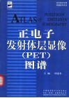 正电子发射体层显像 PET 图谱