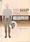 髋部骨折 封面