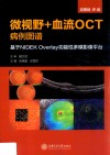 微视野＋血流OCT病例图谱  基于NIDEK Overlay功能性多模影像平台