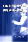 妇科与围产常见病病理取材及诊断