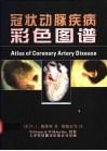 冠状动脉疾病彩色图谱