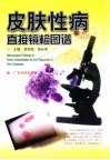 皮肤性病直接镜检图谱