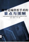股骨近端骨折手术的要点与图解