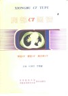 胸部CT图谱 常规CT 螺旋CT 高分辨CT