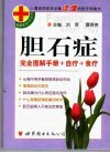 胆石症  完全图解手册+自疗+食疗