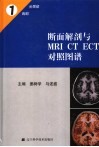 断面解剖与MRI CT ECT对照图谱 中英文本 1 头颈部、胸部
