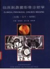 临床副鼻窦影像诊断学 X线·CT·MRI