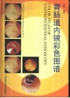 胃肠道内镜彩色图谱