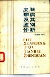 皮肤癣病及其鉴别诊断