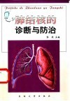 肺结核的诊断与防治封面