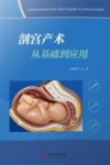 剖宫产术从基础到应用