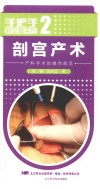 剖宫产术  产科手术的操作规范