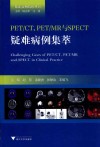 PET/CT  PET/MR与SPECT疑难病例集萃