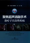 聚焦超声消融手术治疗子宫良性疾病
