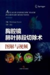 胸腔镜肺叶肺段切除术图解与视频 电子书封面