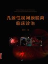 孔源性视网膜脱离临床诊治