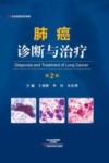 肺癌诊断与治疗  第2版封面