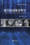 磁共振成像诊断学