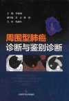周围型肺癌诊断与鉴别诊断封面