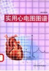 实用心电图图谱 封面