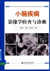 小肠疾病影像学检查与诊断