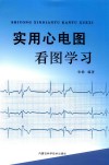 实用心电图看图学习