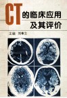 CT的临床应用及其评价封面