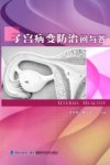 子宫病变防治问与答