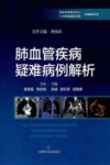 肺血管疾病疑难病例解析