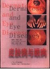 皮肤病与眼病