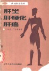 肝炎肝硬化肝癌