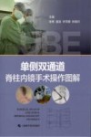 单侧双通道脊柱内镜手术操作图解