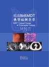 结直肠癌MDT典型病例荟萃封面