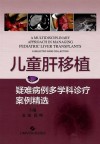 儿童肝移植  疑难病例多学科诊疗案例精选封面