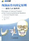 颅颌面骨内固定原则  创伤与正颌外科