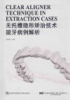 无托槽隐形矫治技术拔牙病例解析封面