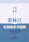 梁林江肛肠病手术图解
