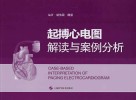 起搏心电图解读与案例分析