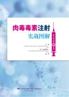 肉毒毒素注射实战图解