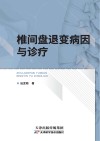 椎间盘退变病因与诊疗