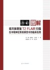 图解磁共振增强T2FLAIR扫描在中枢神经系统病变中的临床应用封面