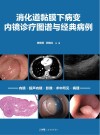 消化道黏膜下病变内镜诊疗图谱与经典病例封面