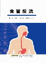 食管反流封面