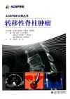 转移性脊柱肿瘤封面